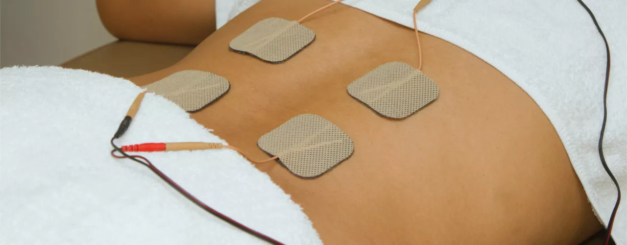 Electrical Stimulation Therapy West Bloomfield, MI